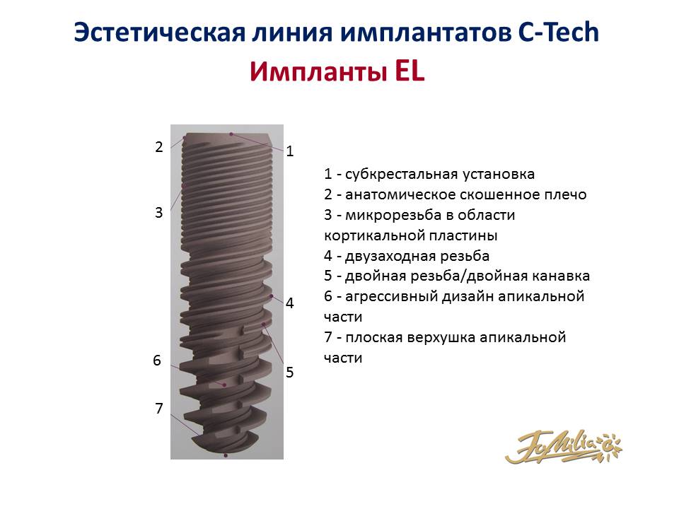 Кортикальный имплант